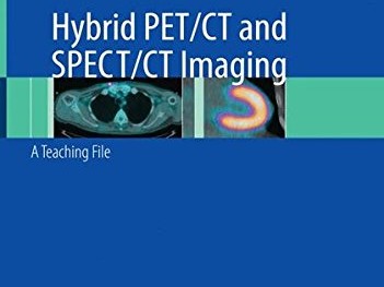 Pet Ct Scan Cost in India: An In-Depth Guide to Affordable and High-Quality Imaging Services